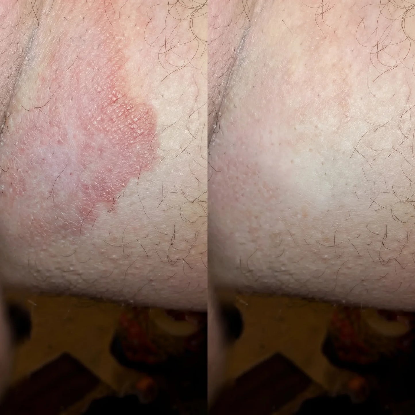 ZenCleanse Antifungal Soap