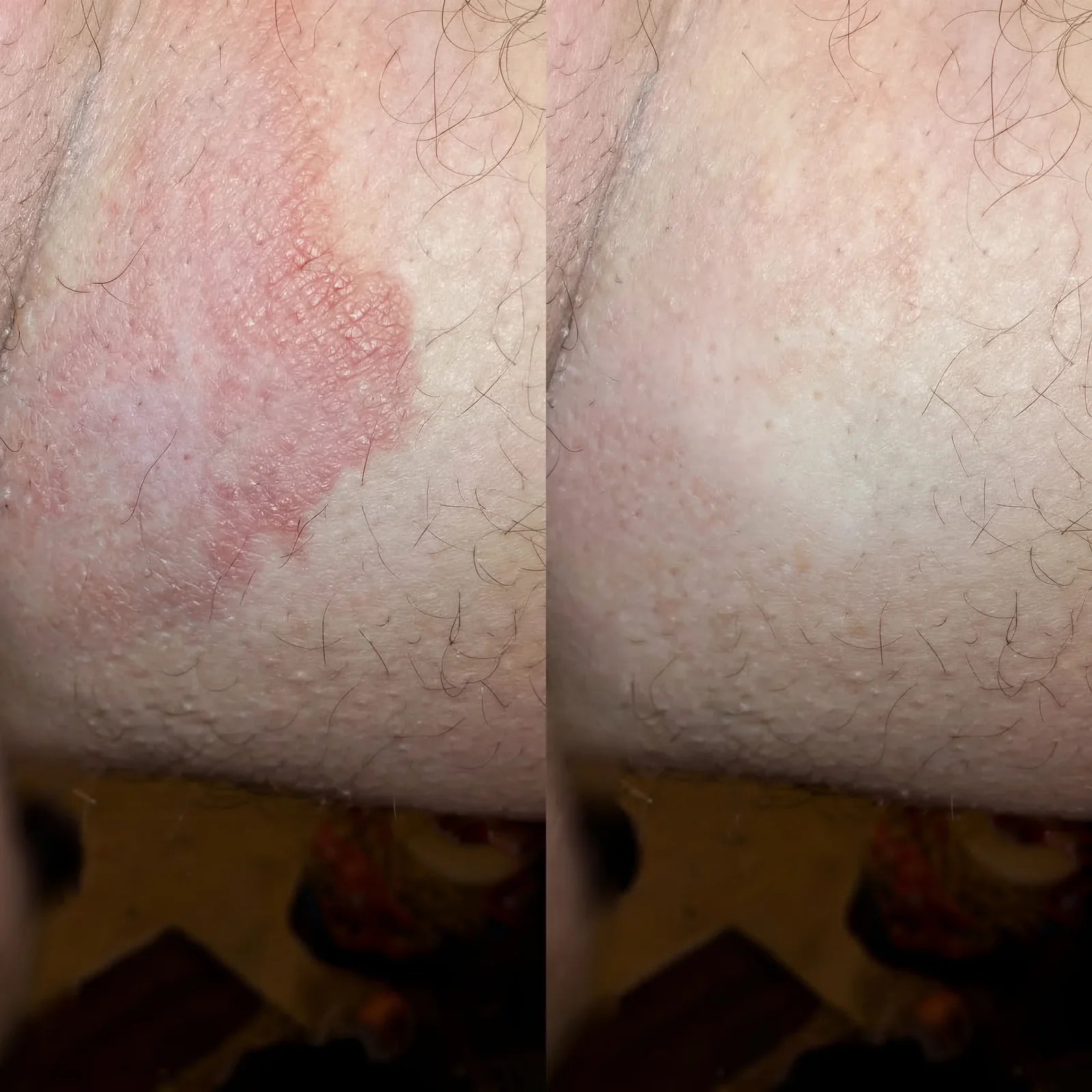 ZenCleanse Antifungal Soap