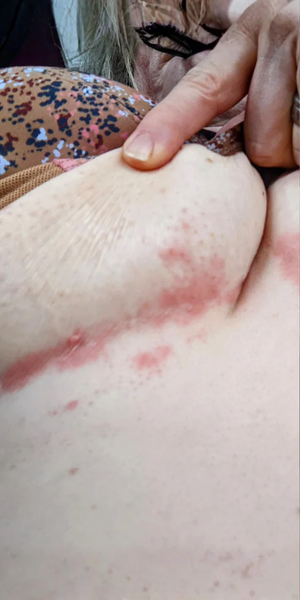 Before using Zencleanse Soap