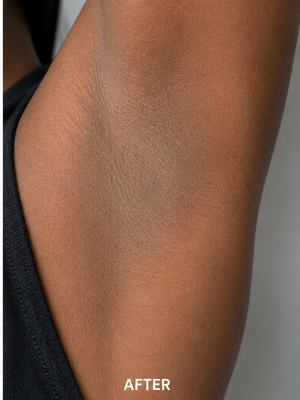 After using Zencleanse Soap