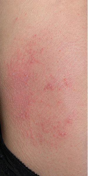 Before using Zencleanse Soap
