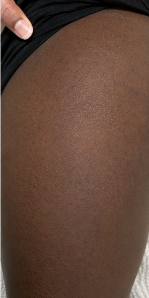 After using Zencleanse Soap