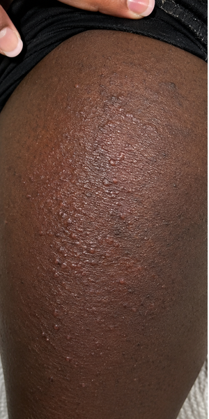 Before using Zencleanse Soap