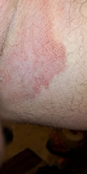 Before using Zencleanse Soap