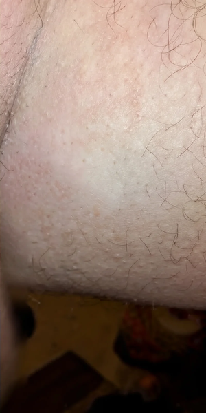 After using Zencleanse Soap